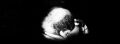 Black and white image of man with his head in his hands.